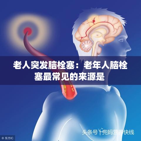 老人突发脑栓塞：老年人脑栓塞最常见的来源是 