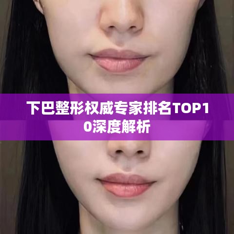 下巴整形权威专家排名TOP10深度解析